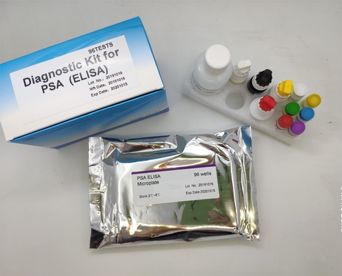 의학 급속한 진단 96pcs Elisa 시험 장비 Hbsag B형 간염 표면 항원