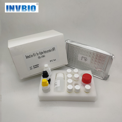 의료용 MSDS 키트 테스트 Elisa Rapid Diagnostic T3 T4 HIV HBsAg CA PSA AFP