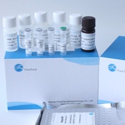 Fsc는 elisa 장비 인간 Ifnw1 인터페론 Omega-1을 증명했습니다